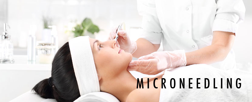 Discover Microneedling at Wisconsin Vein Center & MediSpa Image
