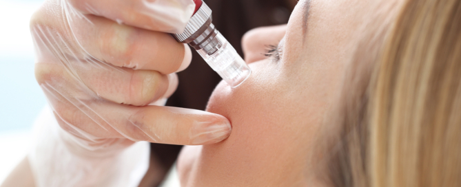 Infini Microneedling for Acne Scarring Image