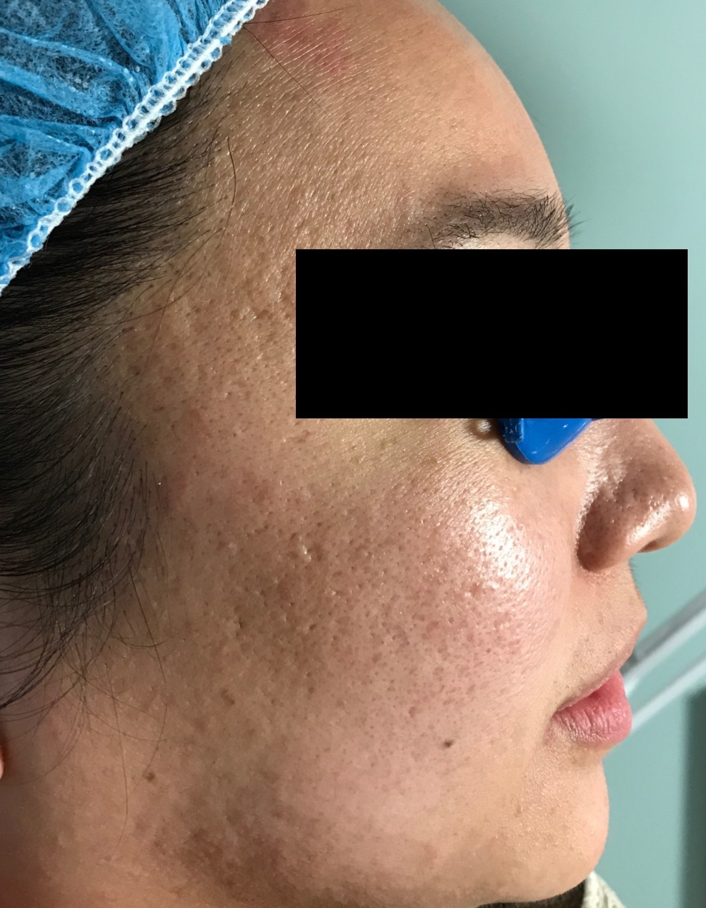Case 247 After Image