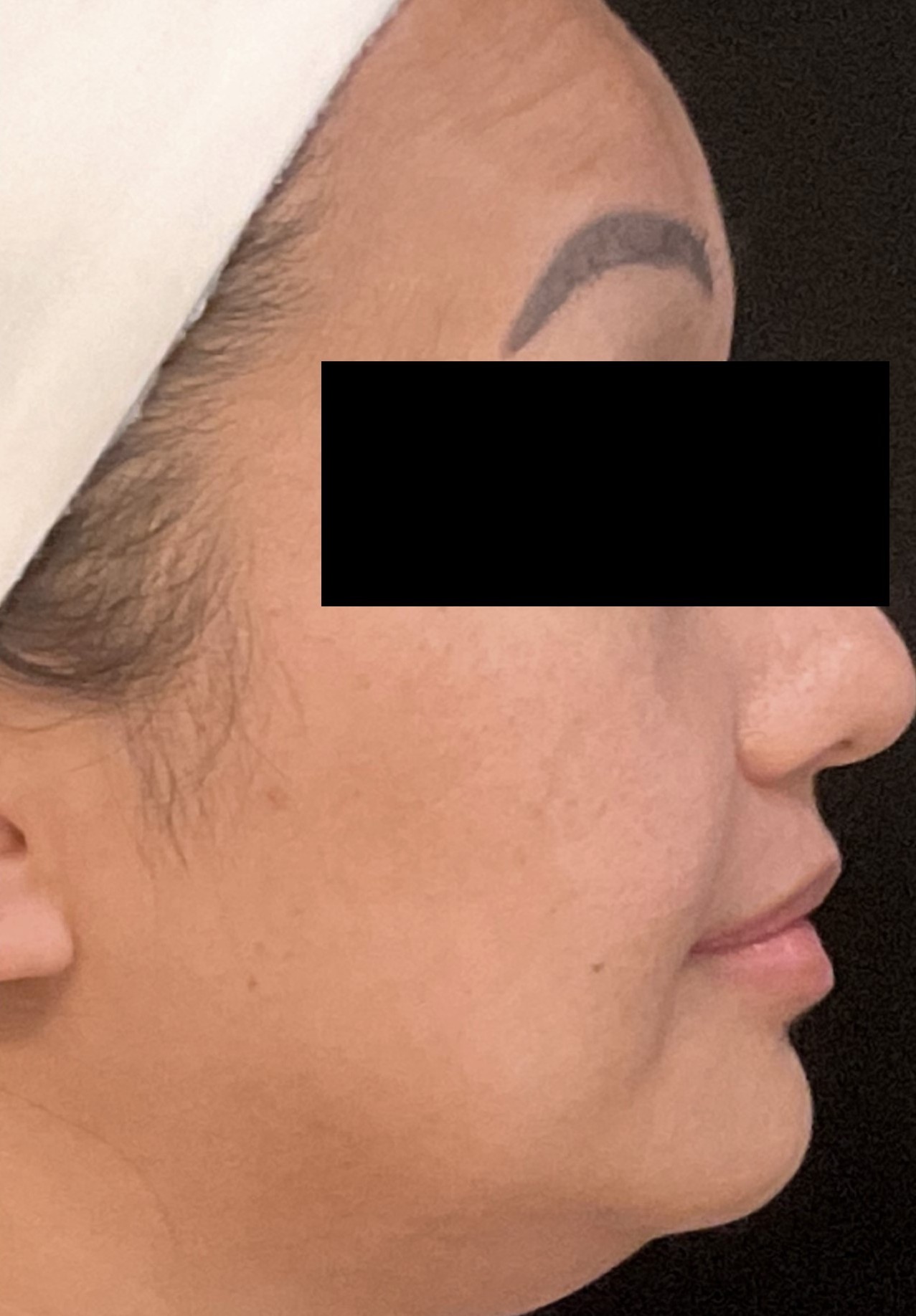 Case 247 Before Image
