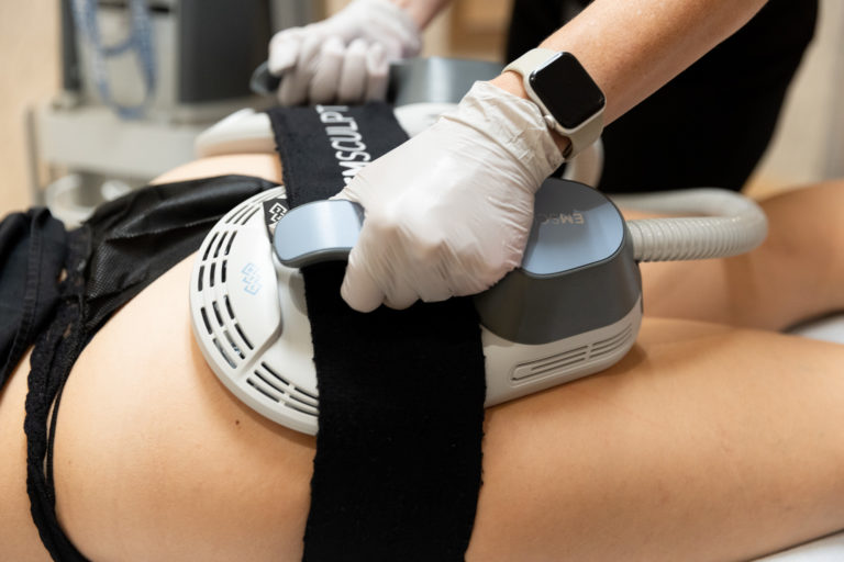 emsculpt near milwaukee Image