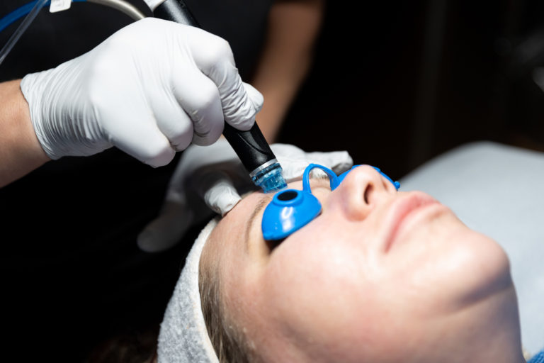 hydrafacial in greater milwaukee Image