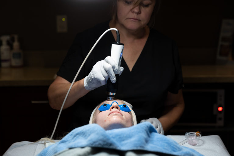 geneo glow2 facial in greater milwaukee Image