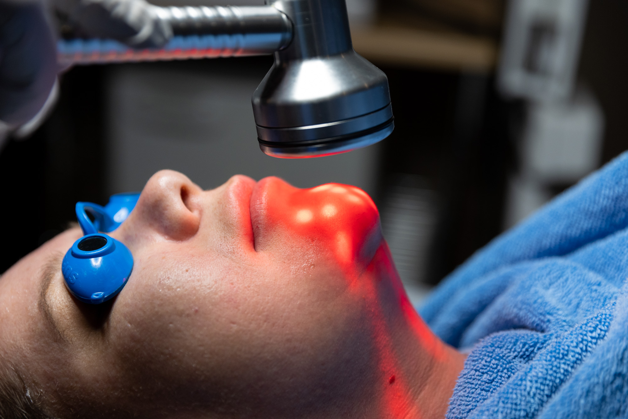 Lasting Acne Relief Image