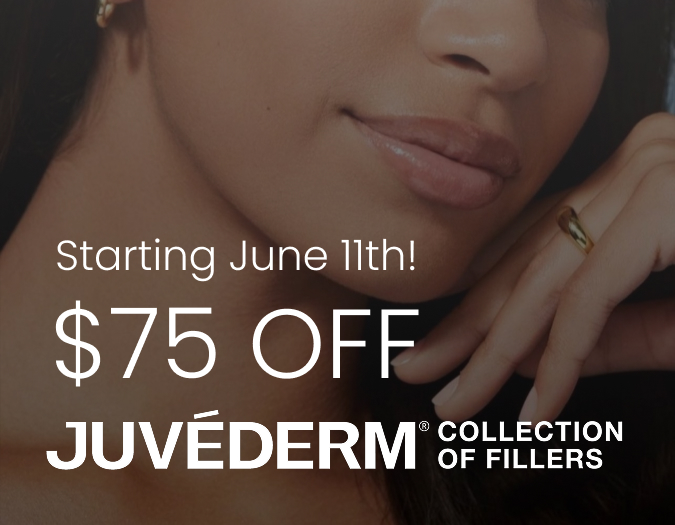 $75 OFF JUVÉDERM® Collection of Fillers Image
